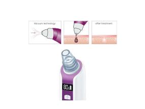 Huokospuhdistin Beurer