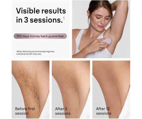 Braun Silk-expert Mini, vaaleanpunainen - Valokuvaepilaattori